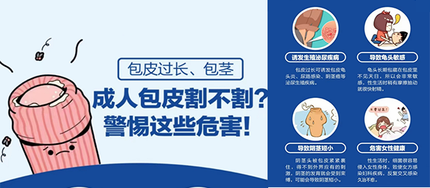 佛山割包皮,佛山割包皮多少钱,佛山正规男科医院,佛山名仕医院